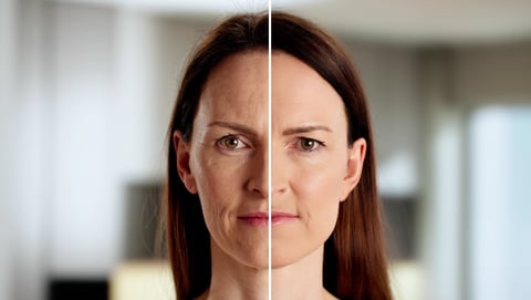 Antes e depois do rosto de Sônia