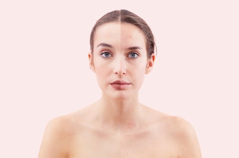 Antes e depois do rosto de Renata