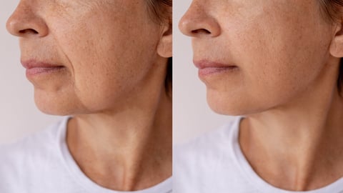 Antes e depois do rosto de Luciana